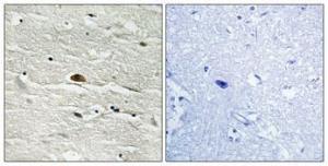 Immunohistochemical analysis of paraffin-embedded human brain using Anti-HMG14 (phospho Ser21) Antibody 1:100 (4 °C overnight). The right hand panel represents a negative control, where the antibody was pre-incubated with the immunising peptide