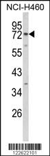 Anti-EXOC5 Rabbit Polyclonal Antibody