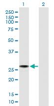 Anti-TMA16 Mouse Polyclonal Antibody