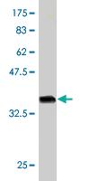 Anti-RARA Mouse Monoclonal Antibody [clone: 2D6]