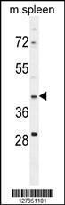 Anti-METAP1D Rabbit Polyclonal Antibody (AP (Alkaline Phosphatase))