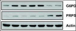 Anti-PRPS1, PRPS2, PRPS3 Rabbit Polyclonal Antibody (AP (Alkaline Phosphatase))