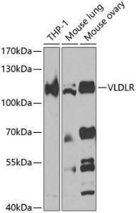 Western blot analysis of extracts of various cell lines, using Anti-VLDL Receptor/VLDL-R Antibody (A10121) at 1:1,000 dilution