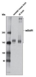 Anti-GRM1 Rabbit Monoclonal Antibody [clone: 13G51]