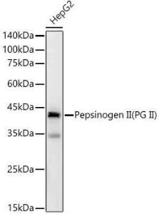 Anti-Pepsinogen II/PGC Rabbit Monoclonal Antibody [clone: ARC57719]