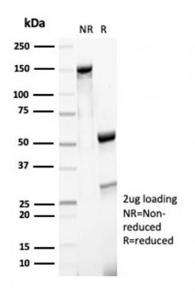 SDS-PAGE analysis of Anti-MSH6 Antibody [MSH6/7065R] under non-reduced and reduced conditions; showing intact IgG and intact heavy and light chains, respectively. SDS-PAGE analysis confirms the integrity and purity of the Antibody