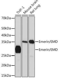 Western blot analysis of extracts of various cell lines, using Anti-Emerin Antibody [ARC0921] (A308435) at 1:1,000 dilution