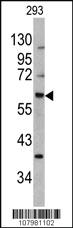 Anti-ACN9 Rabbit Polyclonal Antibody