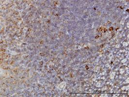 Anti-TCP1 Mouse Monoclonal Antibody [clone: 2B2-D6]