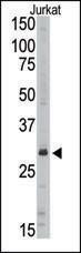 Anti-SIRT5 Rabbit Polyclonal Antibody (APC (Allophycocyanin))