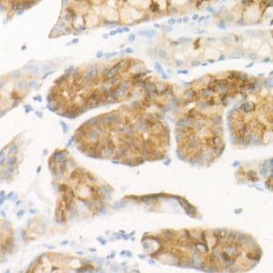 Anti-Pepsinogen II/PGC Rabbit Monoclonal Antibody [clone: ARC57719]