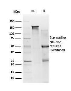 SDS-PAGE analysis of Anti-SMAD3 Antibody [PCRP-SMAD3-1A2] under non-reduced and reduced conditions; showing intact IgG and intact heavy and light chains, respectively. SDS-PAGE analysis confirms the integrity and purity of the antibody