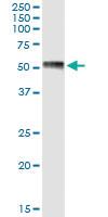 Anti-ESRRG Polyclonal Antibody Pair