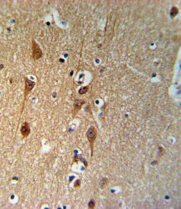 Anti-SMAD3 Rabbit Polyclonal Antibody