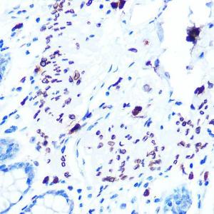 Immunohistochemistry analysis of paraffin-embedded human colon tissue using Anti-Emerin Antibody [ARC0921] (A308435) at a dilution of 1:100 (40X lens). Perform microwave antigen retrieval with 10 mM PBS buffer pH 7.2 before commencing with IHC staining protocol