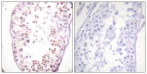 Immunohistochemical analysis of paraffin-embedded human testis using Anti-HDAC6 (phospho Ser22) Antibody. The right hand panel represents a negative control, where the Antibody was pre-incubated with the immunising peptide