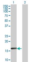 Anti-RARRES3 Mouse Polyclonal Antibody