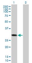 Anti-ABCC10 Mouse Polyclonal Antibody