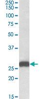 Anti-ETFB Goat Polyclonal Antibody