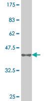 Anti-NOG Mouse Monoclonal Antibody [clone: 2C10]