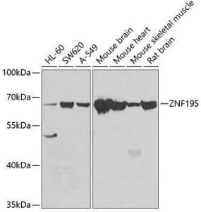 Western blot analysis of extracts of various cell lines, using Anti-ZNF195 Antibody (A10123) at 1:1,000 dilution. The secondary antibody was Goat Anti-Rabbit IgG H&L Antibody (HRP) at 1:10,000 dilution.