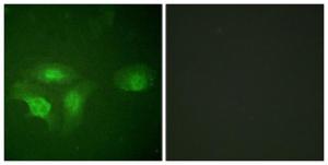 Immunofluorescence analysis of HepG2 cells using Anti-HDAC6 (phospho Ser22) Antibody. The right hand panel represents a negative control, where the Antibody was pre-incubated with the immunising peptide