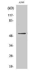 Anti-GIPR antibody