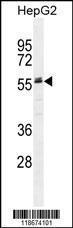 Anti-AHSG Rabbit Polyclonal Antibody (PE (Phycoerythrin))