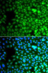 Immunofluorescence analysis of A549 cells using Anti-ZNF195 Antibody (A10123). DAPI was used to stain the cell nuclei (blue).