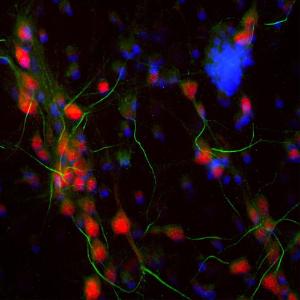 Anti-Ankyrin 3 antibody