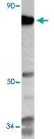 Anti-PRKCD Rabbit Polyclonal Antibody