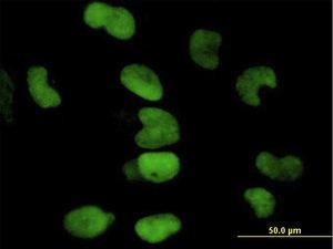 Anti-TRIM28 Mouse Monoclonal Antibody [clone: 4E6]