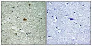 Immunohistochemical analysis of paraffin-embedded human brain using Anti-HDAC6 (phospho Ser22) Antibody 1:100 (4 °C overnight). The right hand panel represents a negative control, where the Antibody was pre-incubated with the immunising peptide