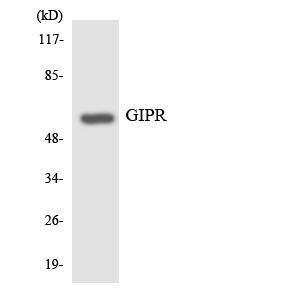 Western blot analysis of the lysates from HT 29 cells using Anti-GIPR Antibody