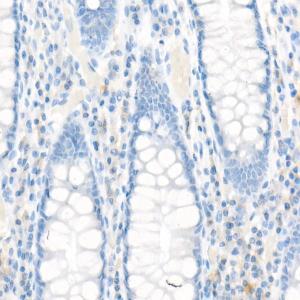 Immunohistochemistry analysis of paraffin-embedded human colon tissue using Anti-MRP1 Antibody [ARC52207] (A305805) at a dilution of 1:100(40x lens)