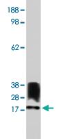 Anti-ALOX5AP Rabbit Polyclonal Antibody