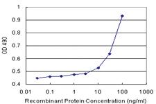 Anti-AGTRAP Antibody Pair