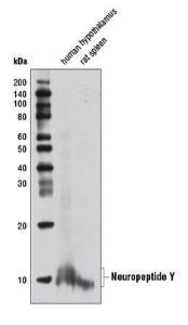 Anti-NPY Rabbit Monoclonal Antibody [clone: 13G53]