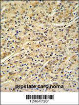 Anti-HOXA3 Rabbit Polyclonal Antibody (AP (Alkaline Phosphatase))