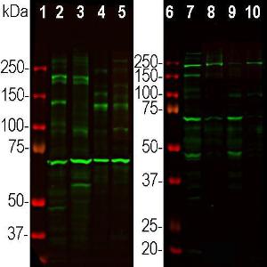 Anti-Ankyrin 3 antibody