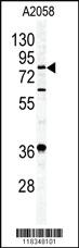 Anti-APEH Rabbit Polyclonal Antibody