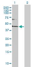 Anti-FADS3 Rabbit Polyclonal Antibody