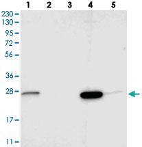 Anti-SIGMAR1 Rabbit Polyclonal Antibody