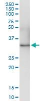 Anti-GNMT Polyclonal Antibody Pair