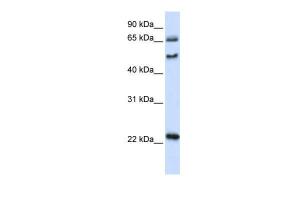 Anti-UNCX Rabbit Polyclonal Antibody