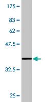 Anti-ZMYND8 Mouse Monoclonal Antibody [clone: 6A12]