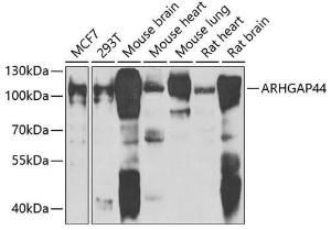 Western blot analysis of extracts of various cell lines, using Anti-ARHGAP44 Antibody (A10127) at 1:1,000 dilution. The secondary antibody was Goat Anti-Rabbit IgG H&L Antibody (HRP) at 1:10,000 dilution.