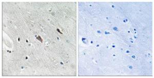 Immunohistochemical analysis of paraffin-embedded human brain using Anti-Gab2 (phospho Tyr643) Antibody. The right hand panel represents a negative control, where the antibody was pre-incubated with the immunising peptide.