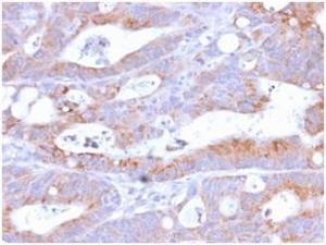 Immunohistochemical analysis of formalin-fixed, paraffin-embedded human colon using Anti-NULL Antibody [C86/2160R]