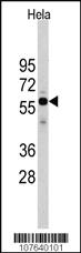 Anti-CDC25A Rabbit Polyclonal Antibody